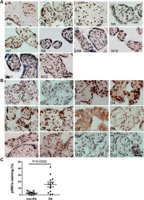 Obesity impacts placental function through activation of p-IRE1a-XBP1s signaling